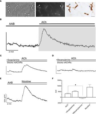 Acetylcholine regulation of GnRH neuronal activity: A circuit in the medial septum